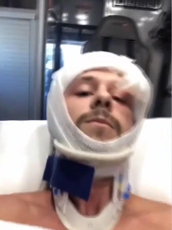 bi ca sau can vao dau anh 2