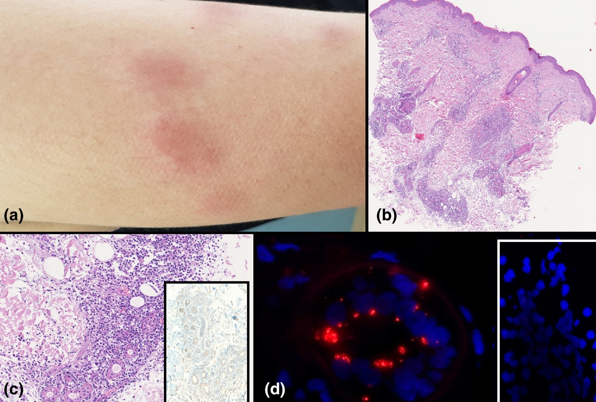 Covid19 co o Italy truoc Vu Han anh 2