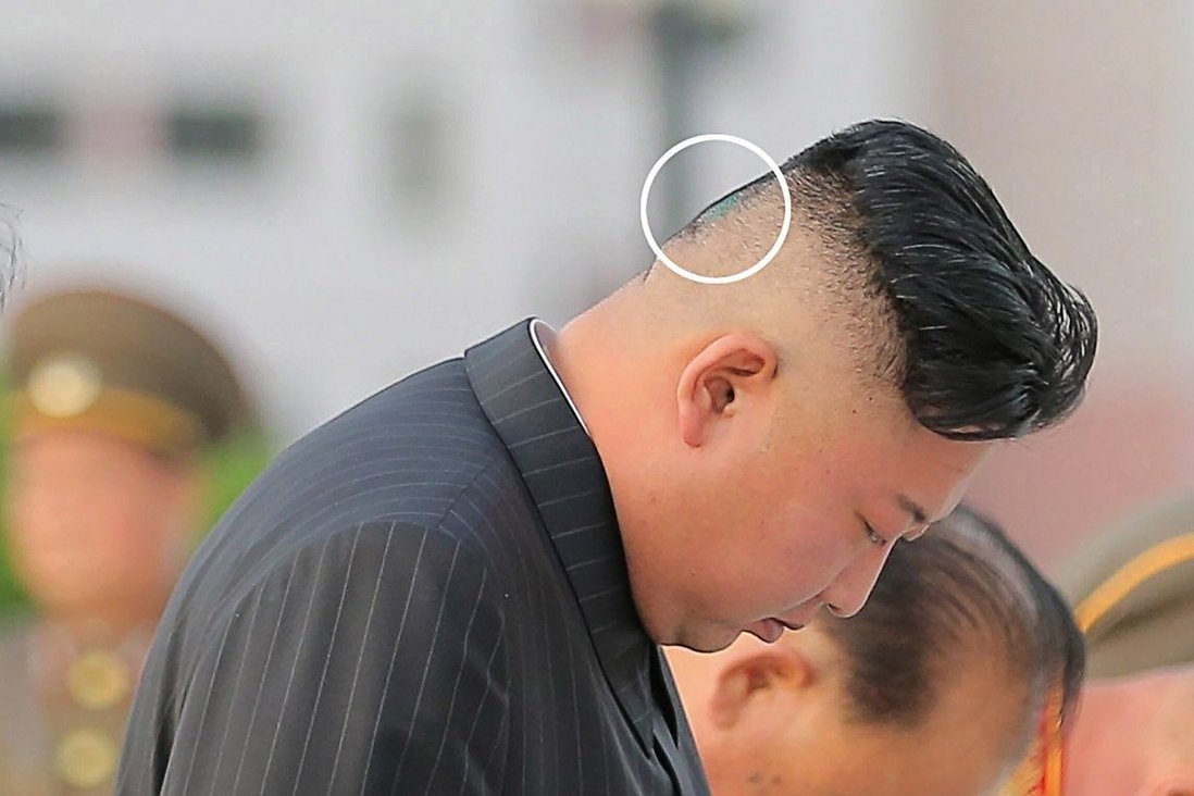 Bang dan sau dau ong Kim Jong Un anh 2