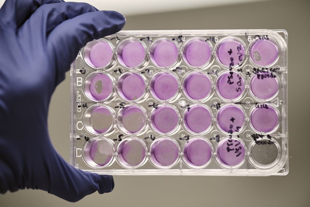 Vi sao Novavax cham Moderna anh 5