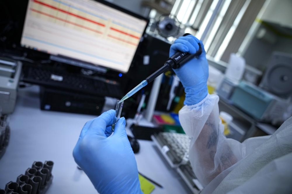 Vi sao nguoi Nga do xo di xet nghiem khang the? hinh anh