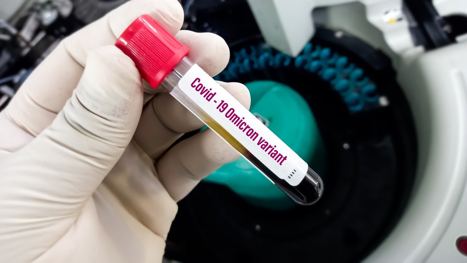 Omicron it gay ton thuong toi phoi hon so voi cac bien chung khac hinh anh