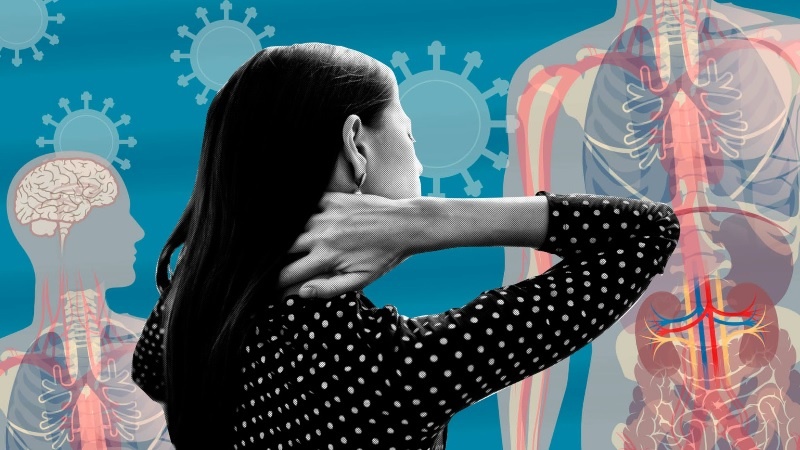 hoi chung hau Covid19 anh 1