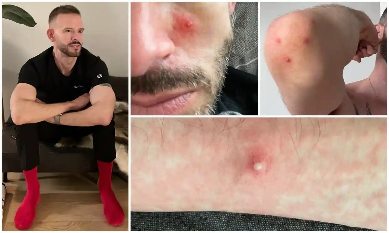 trai nghiem mac dau mua khi o My anh 2