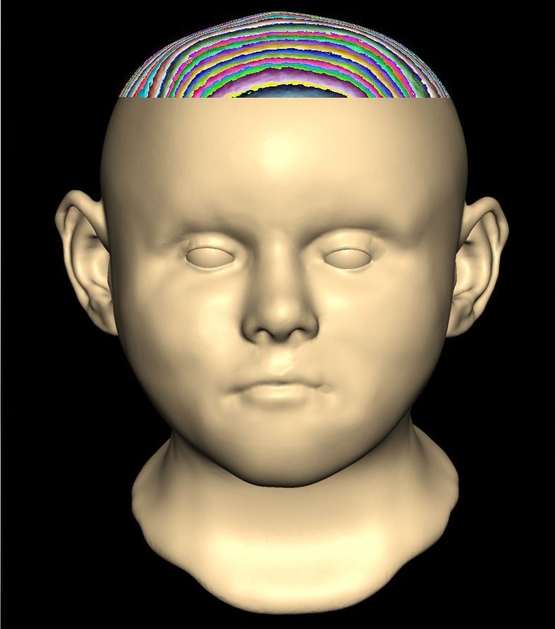 xac chet gieng trung co anh 1