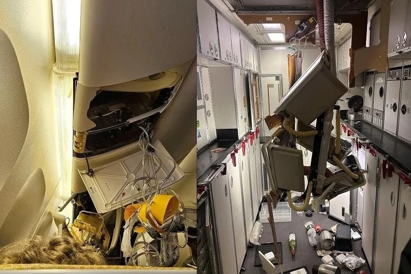 Singapore Airlines boi thuong 10.000 USD cho khach bi thuong nhe hinh anh