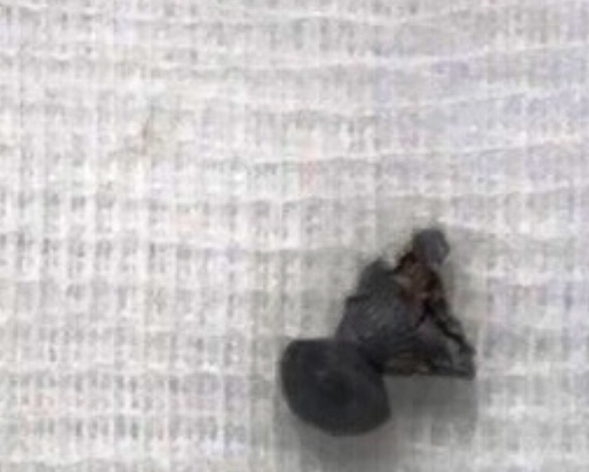 dau dan,  sung bi,  di vat duong tho,  be trai anh 1