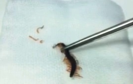 côn trùng chui vào tai ảnh 1 con trung chui vao tai anh 1