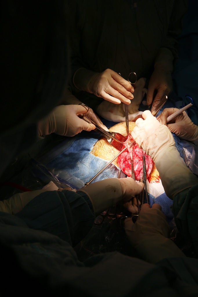 Nguoi phu nu mang khoi u nang nhat Viet Nam hinh anh