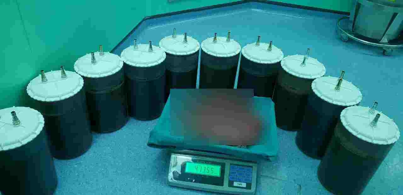 khối u khủng nhất Việt Nam ảnh 2 khoi u khung nhat Viet Nam anh 2