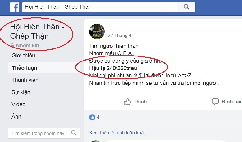 buôn bán tạng ảnh 1 buon ban tang anh 1