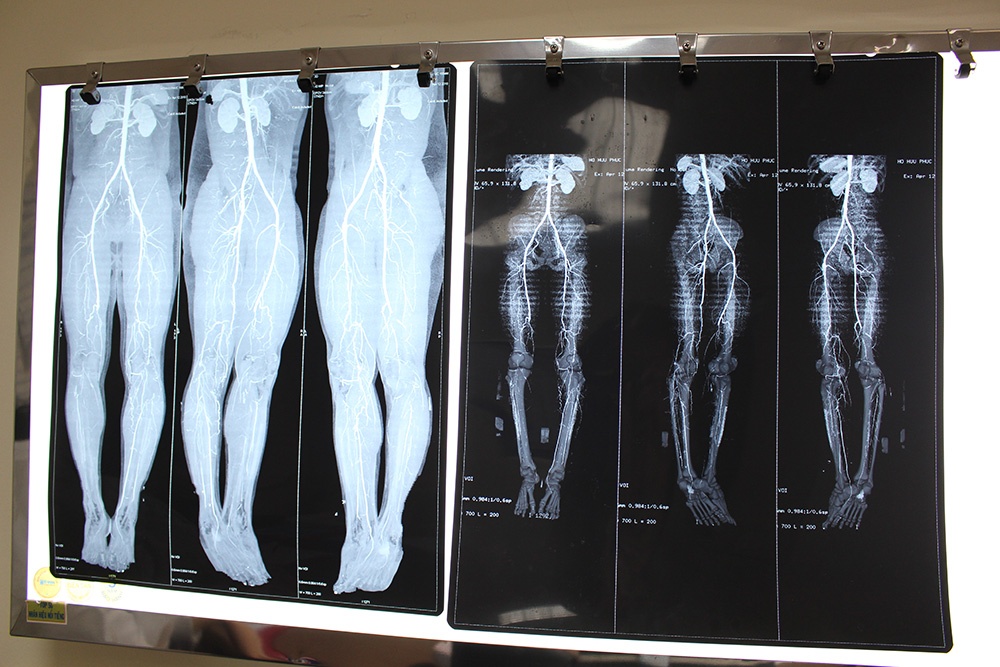 giữ lại đôi chân ảnh 1 giu lai doi chan anh 1