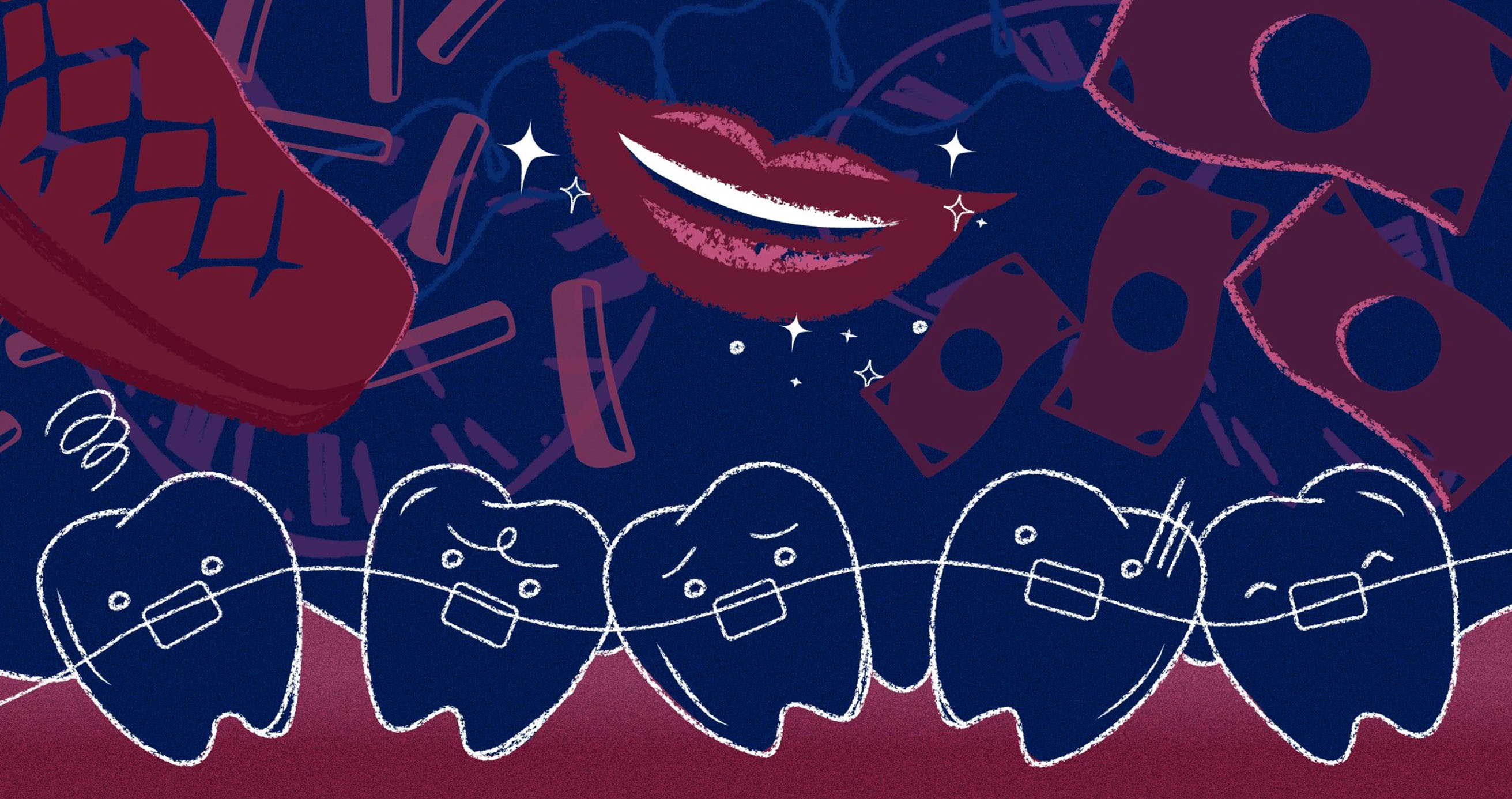 5 dieu toi uoc minh biet truoc khi nieng rang hinh anh