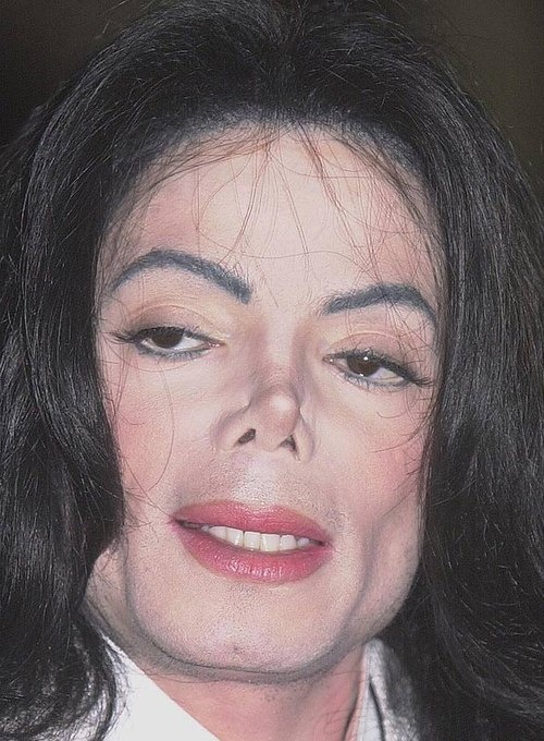 Lạm dụng phẫu thuật thẩm mỹ, khuôn mặt của Michael ngày càng biến đổi theo hướng… quái dị hơn.