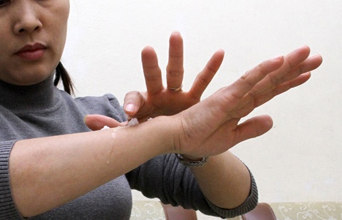 Da khô chủ yếu do cơ thể bị mất nước.