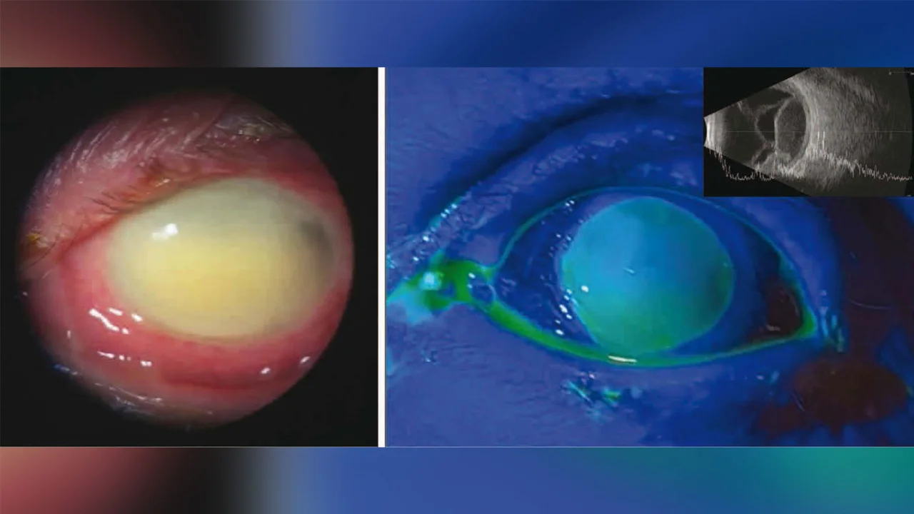 Vu thuoc nho mat gay mu, tu vong chan dong nuoc My hinh anh