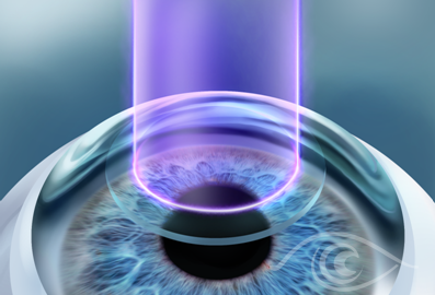 phẫu thuật mắt tại Trung tâm Mắt kỹ thuật cao ảnh 1 phau thuat mat tai Trung tam Mat ky thuat cao anh 1