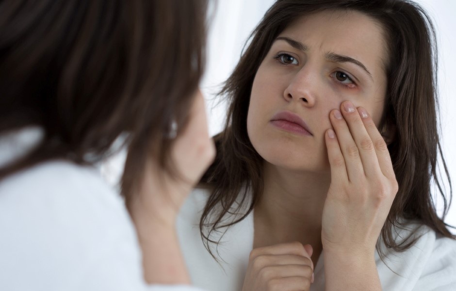 Phuong phap phong va chua leo mat hinh anh