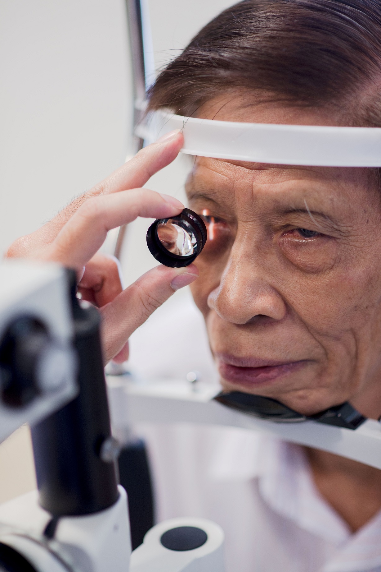 Mat van mo sau khi mo duc thuy tinh the anh 1