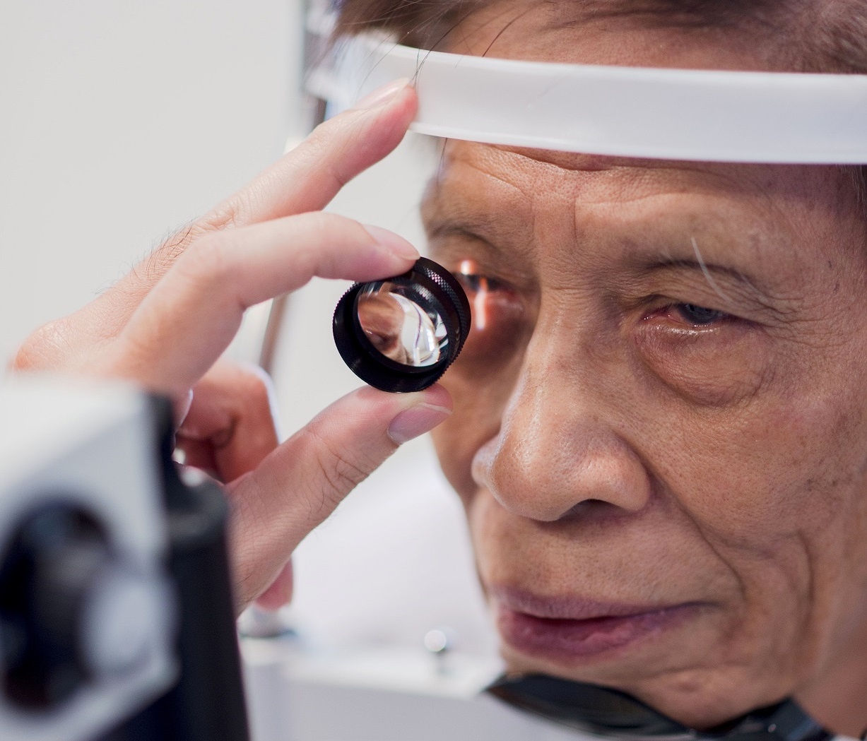 Mat van mo sau khi mo duc thuy tinh the hinh anh