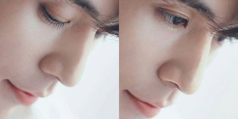 lee dong wook phau thuat tham my anh 5