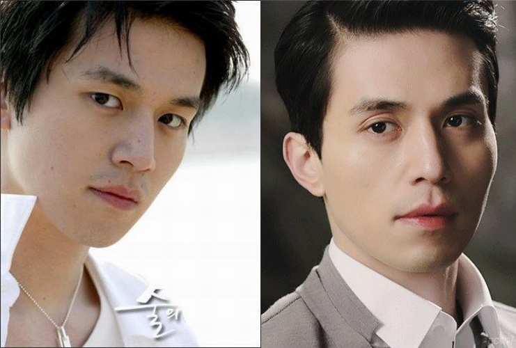 lee dong wook phau thuat tham my anh 6