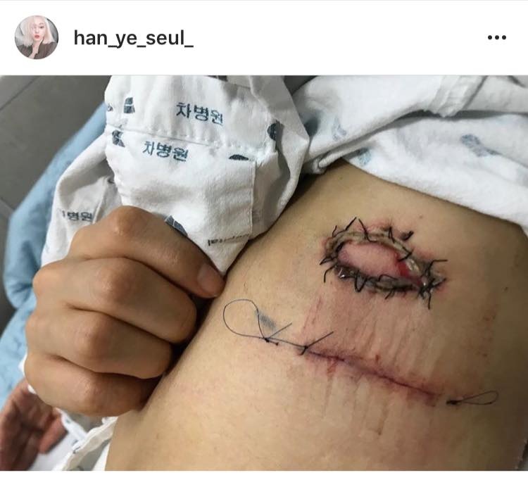 han ye seul phau thuat u mo anh 1