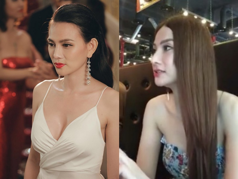 thu thuy phau thuat tham my anh 4