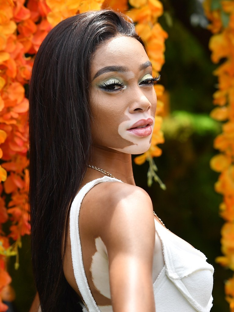 winnie harlow dien victoria's secret anh 2
