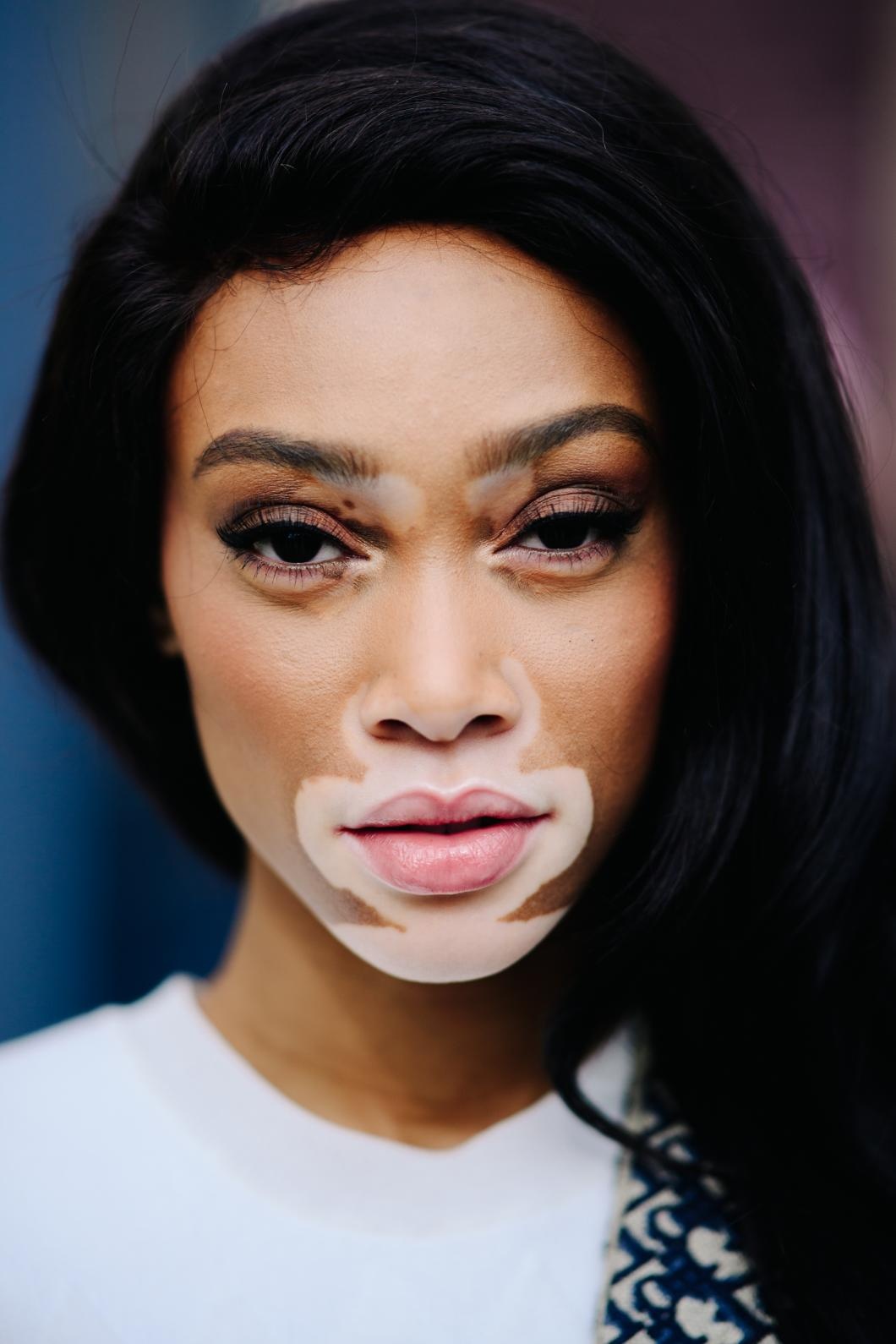 winnie harlow dien victoria's secret anh 1