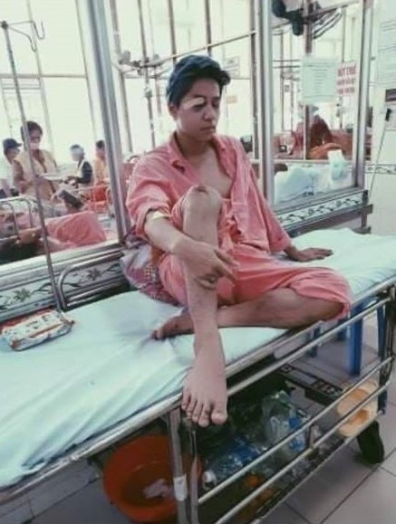 bui duy ngoc tai nan chan thuong anh 1