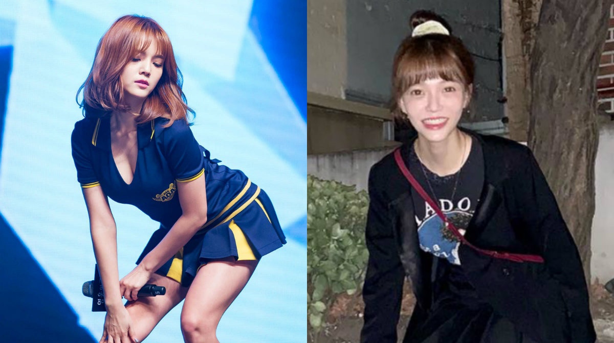 Truong nhom AOA - phau thuat tham my, mac chung bieng an hinh anh