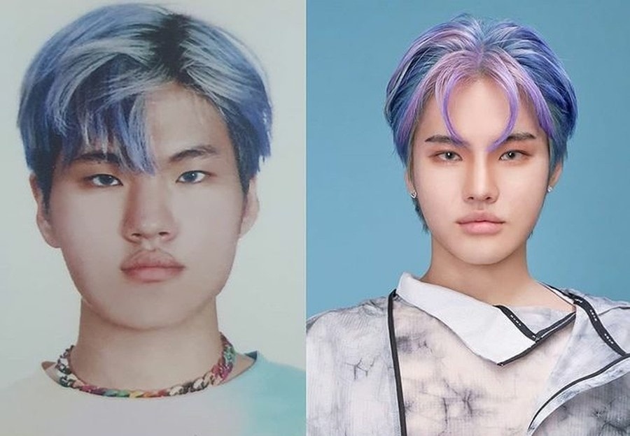 rapper han giai thich ly do phau thuat tham my anh 1