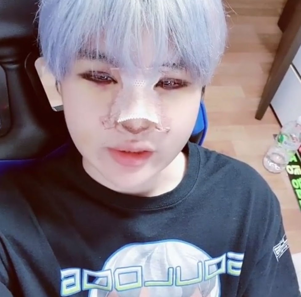 rapper han giai thich ly do phau thuat tham my anh 2