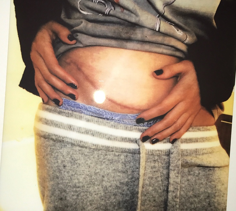 selena gomez seo phau thuat anh 1