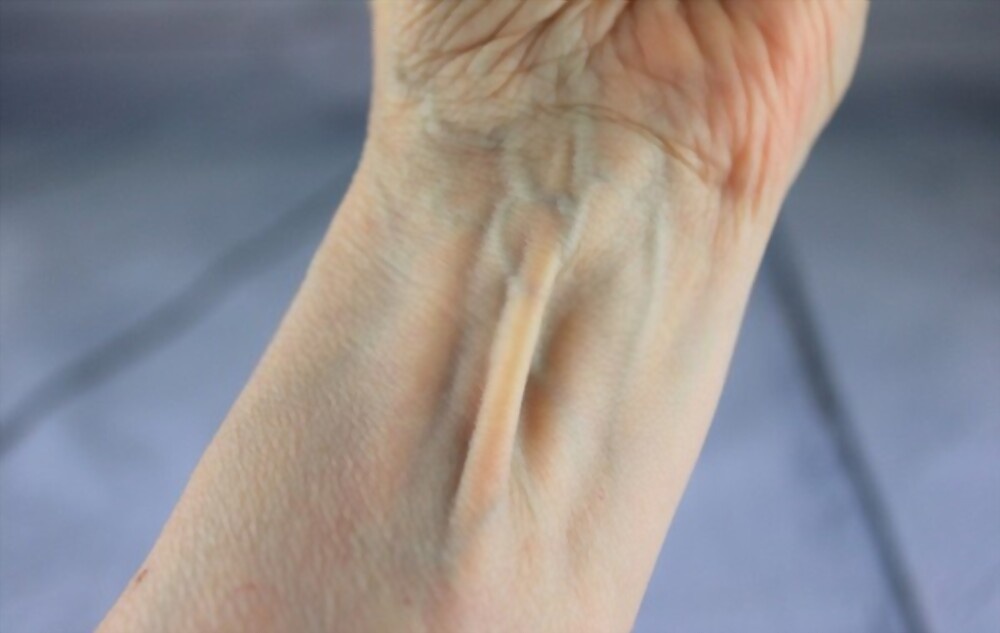 10 bo phan bi cho la vo dung tren co the nguoi hinh anh