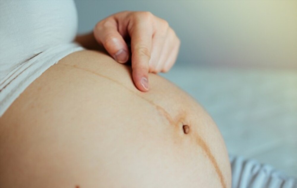 thay doi khi mang thai anh 1