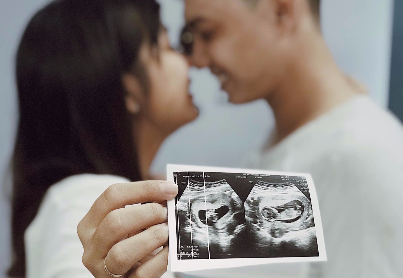 ba bau tiem vaccine ngua Covid-19 anh 4