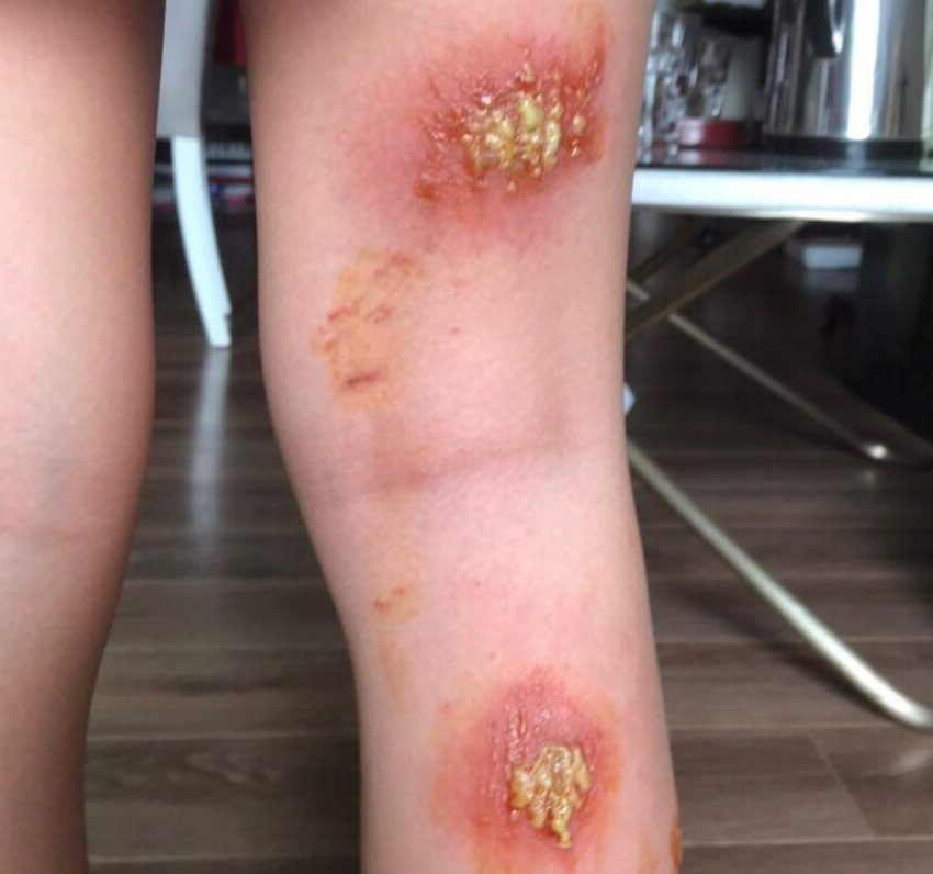 Kien ba khoang o chung cu TP.HCM anh 3