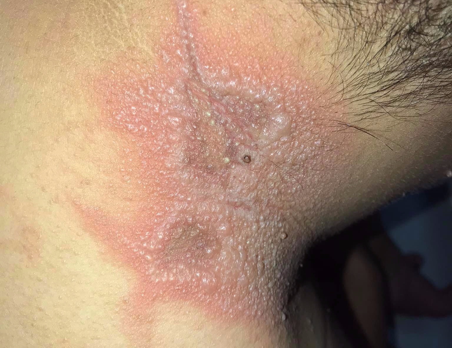 Kien ba khoang o chung cu TP.HCM anh 2