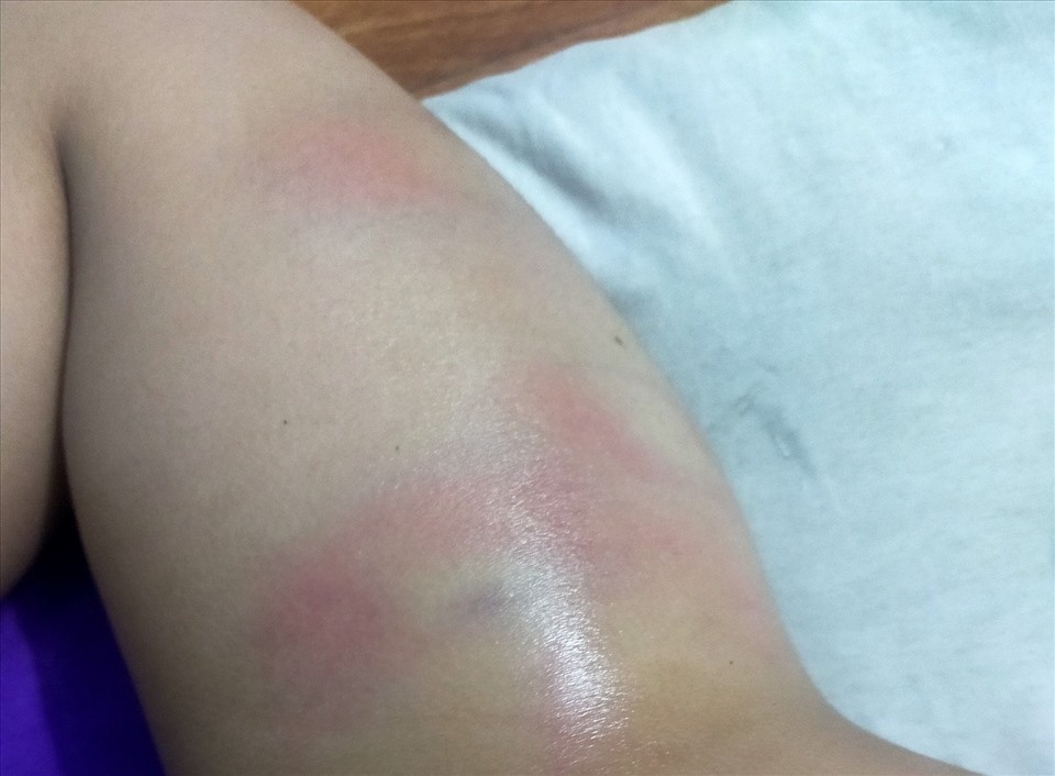 Be gai 4 tuoi bi co giao danh dap vi di ve sinh ra quan hinh anh