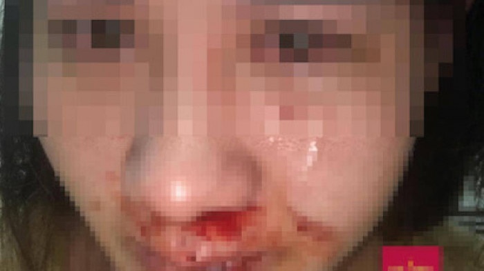 Can bo cong an o Ha Noi bi to hanh hung vo con hinh anh