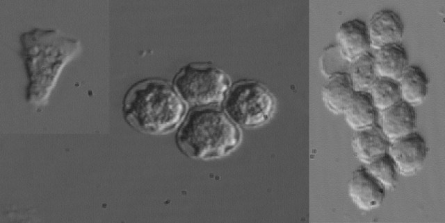 Viêm giác mạc do Acanthamoeba do amip gây ra. Chúng sống tự do trong đất, nước, bụi, bể bơi, ống nước nóng, trong nước biển hay thậm chí cả nước đun sôi. Viêm giác mạc do Ancanthamoeba có thể gặp ở những người khoẻ mạnh, trẻ và có khả năng miễn dịch tốt, đặc biệt hay gặp ở những người đeo kính tiếp xúc. Các yếu tố thuận lợi thường xuất hiện ở những bệnh nhân viêm giác mạc do Ancanthamoe như chấn thương trên giác mạc, đeo kính tiếp xúc, dùng nước bẩn.
