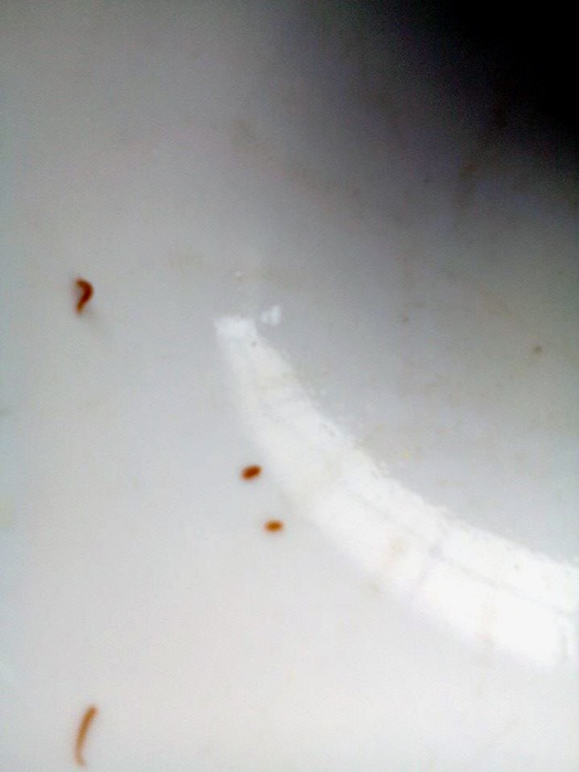 Phát hiện “đỉa non” khi làm cua khiến cộng đồng mạng xôn xao (ảnh: Facebook nhân vật).