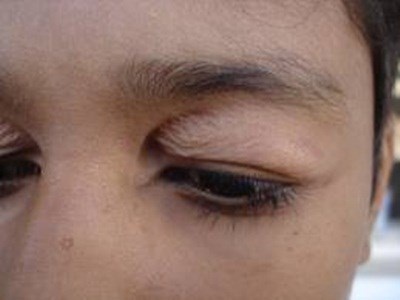 Mat bien dang vi cat mi hinh anh