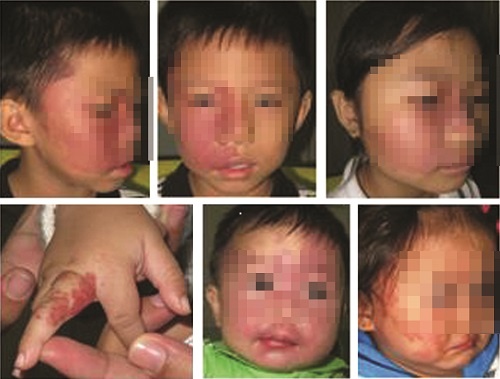 U mau co nguy hiem den tinh mang? hinh anh