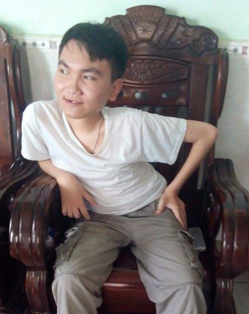 Khách hàng Cao Quang Sơn bị yếu cơ bẩm sinh khi đi thì được Jetstar Pacific vận chuyển nhưng khi về thì phải đi bằng... ôtô.