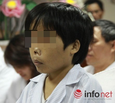 Những bệnh nhân bị bệnh Thalassemia có hình hài