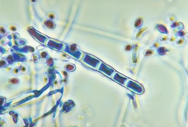 Nấm trichophyton gây bệnh hắc lào.