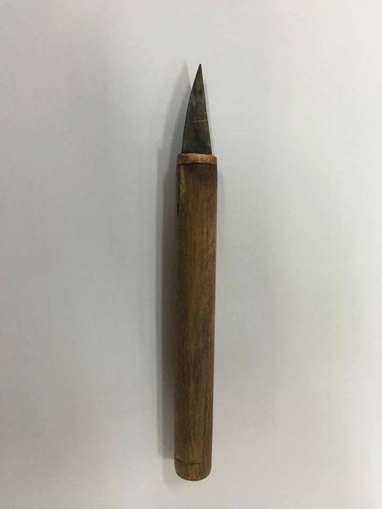 Con dao khiến bé 3 tuổi suýt mất mạng.